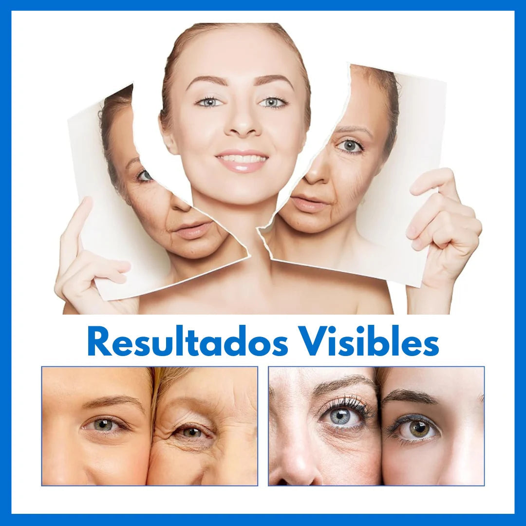REAFIRMA Y REDUCE TU PAPADA Y ARRUGAS🎁REGALO CREMA PARA DOLORES🎁 ¡Luce Radiante y Siéntete Como Nuevo! 🌟
