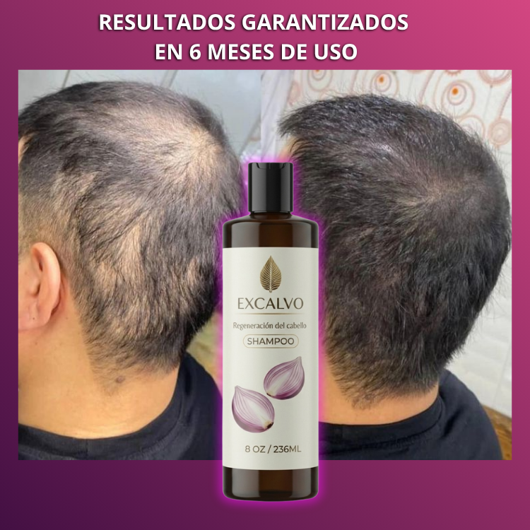 Encabezado