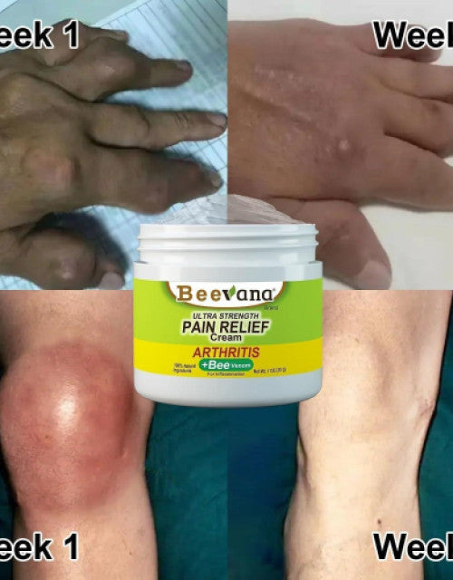 REAFIRMA Y REDUCE TU PAPADA Y ARRUGAS🎁REGALO CREMA PARA DOLORES🎁 ¡Luce Radiante y Siéntete Como Nuevo! 🌟